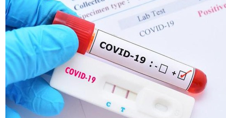 Từ ngày 21/2/2022, giá xét nghiệm SARS-CoV-2 mới tối đa 78.000 đồng/xét nghiệm