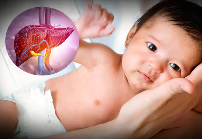Chủ động ứng phó bệnh viêm gan cấp ở trẻ em