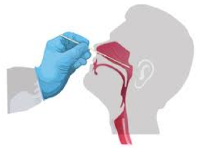 Người tự test nhanh COVID-19 tại nhà cần lưu ý những gì? Người tự test nhanh COVID-19 tại nhà cần lưu ý những gì?