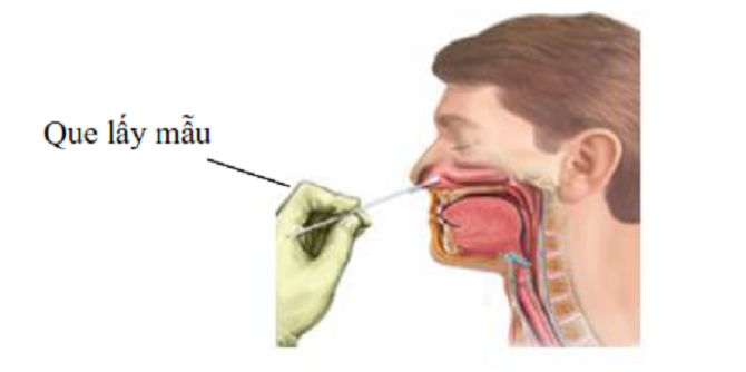 Người tự test nhanh COVID-19 tại nhà cần lưu ý những gì? Người tự test nhanh COVID-19 tại nhà cần lưu ý những gì?