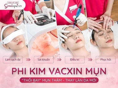 Thẩm mỹ viện SeoulSpa.Vn - Địa điểm cải thiện nhan sắc uy tín
