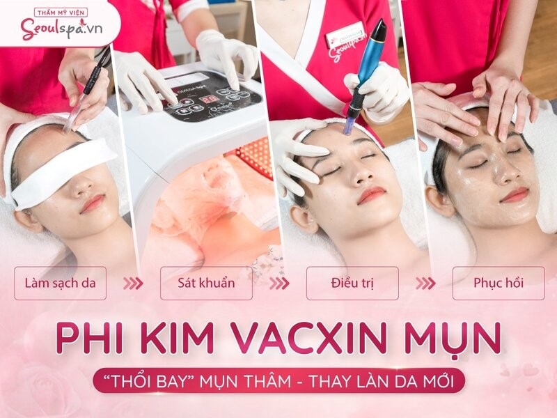 Thẩm mỹ viện SeoulSpa.Vn - Địa điểm cải thiện nhan sắc uy tín Thẩm mỹ viện SeoulSpa.Vn - Địa điểm cải thiện nhan sắc uy tín