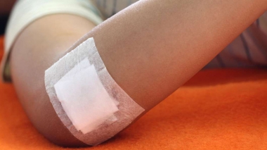 Gạc tẩm bạc giúp lành vết thương nhanh hơn ở người bệnh tiểu đường